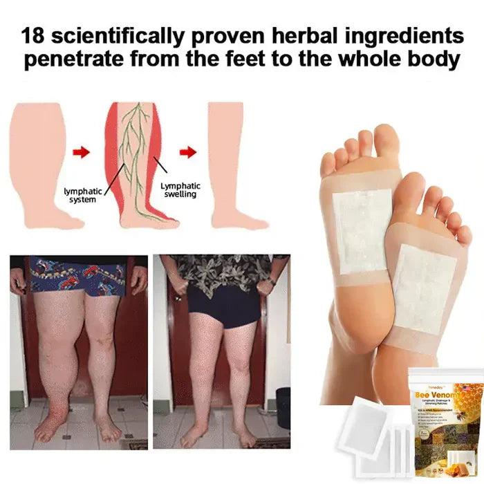 🌿 Buy 1 Get 1 FREE – Bee Venom Lymphatic Drainage & Slimming Foot Patches 👣